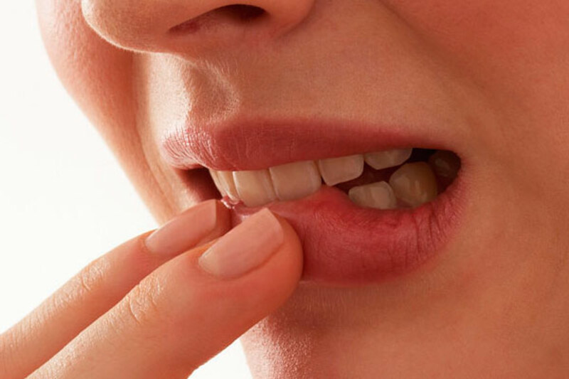 Візуально хворобу можна визначити за маленькими виразками, червоненькими висипами чи біленькими плямками на слизовій рота