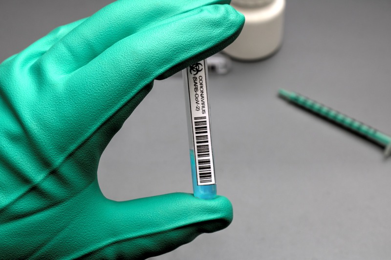 Станом на 17:30 29 листопада На Хмельниччині зареєстровано 353 нові випадки інфікування коронавірусом