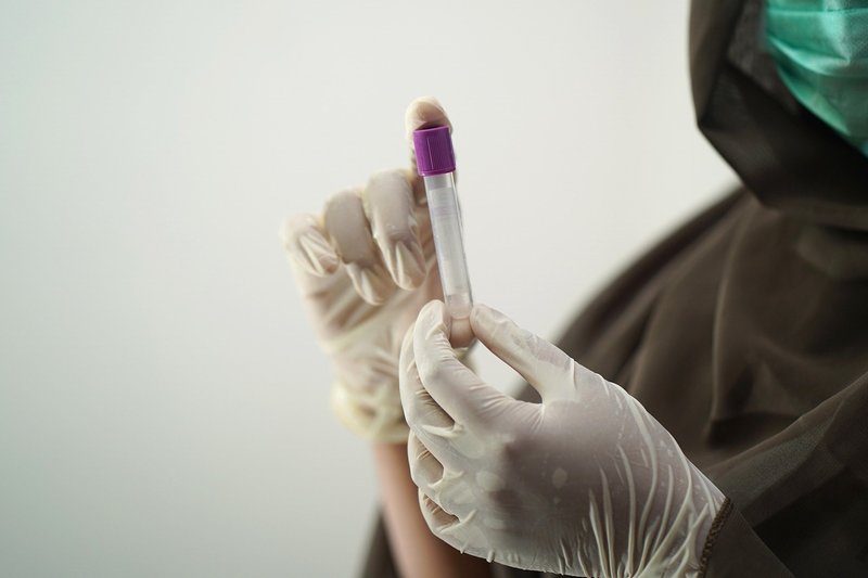 У Хмельницькому тест на коронавірус можна здати у приватних та державних лаболаторіях