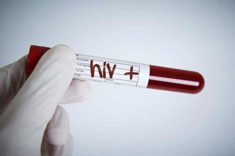 У Хмельницькому декілька днів можна буде пройти безкоштовно та анонімно тестування на ВІЛ