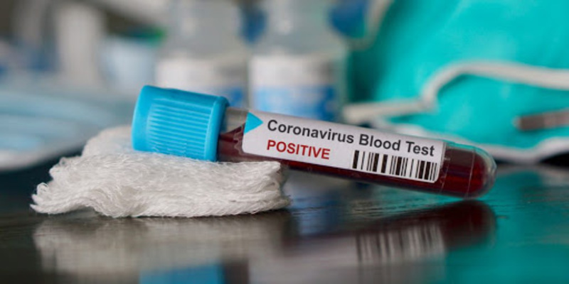 Зазначається, що у Чернівецькій області зареєстровано 10 нових випадків коронавірусу