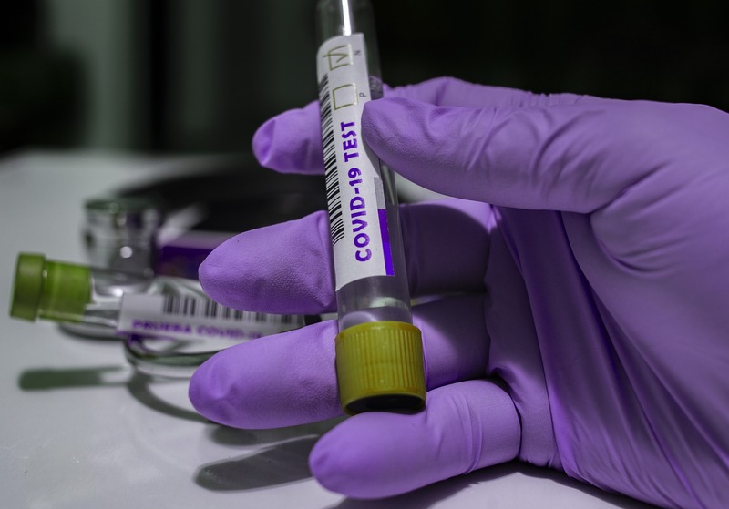 На території області лабораторно підтверджено 326 нових випадків інфікування коронавірусом