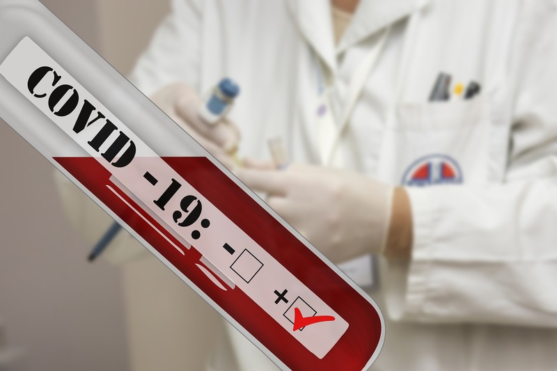 На Хмельниччині станом на 18:30 9 грудня лабораторно підтверджено 359 нових випадків COVID-19