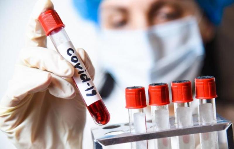 Станом на 21 грудня в Хмельницькій області зареєстровано понад 37 тисяч лабораторно підтверджених випадків COVID-19
