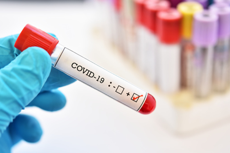 Лікарні знову купують швидкі тести для виявлення Covid-19