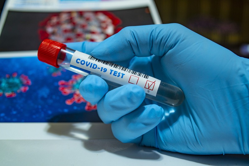 В області 98 громадян захворіли на коронавірус