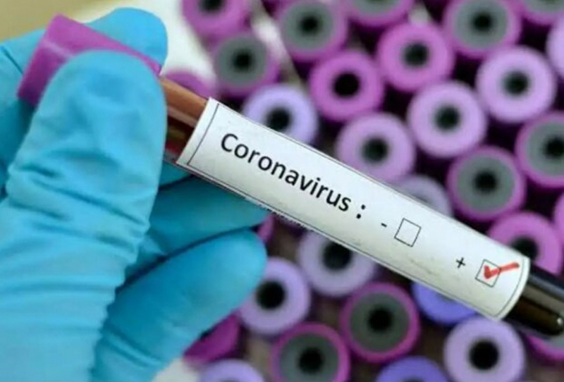 Також, як повідомляє Хмельницька ОДА, наразі є 14 підозр на коронавірусну інфекцію