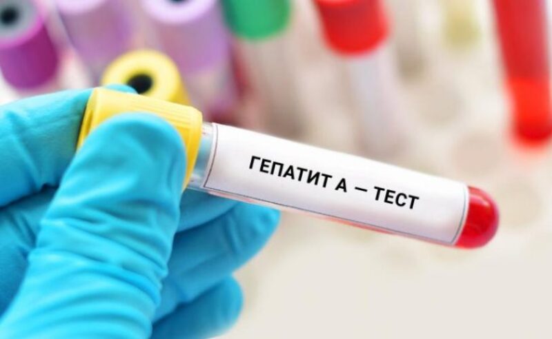 Епідеміологи додають, що випадки захворювання на гепатит А постійно реєструються на території України