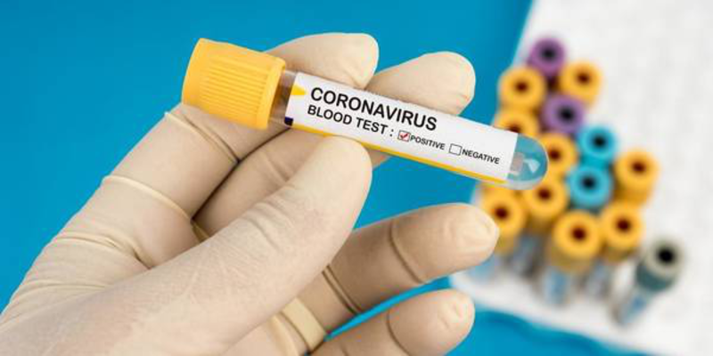 Виявлених хворих з коронавірусом в місті, а також підозр, наразі, немає
