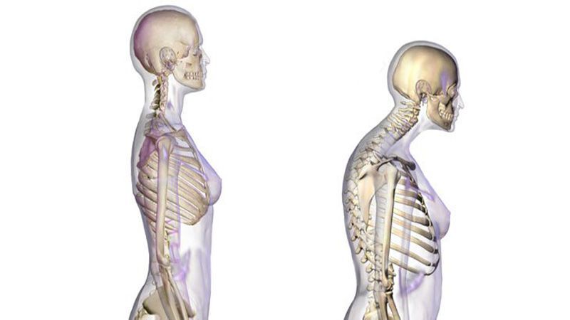 Щоб знайти причину остеопорозу необхідно провести низку досліджень